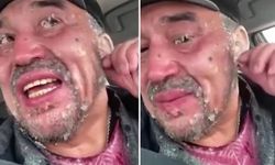 Eksi 50 derecede sıkı giyinmeyen adam buz tuttu!