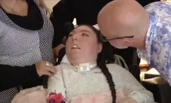 Beyni olmadan dünyaya gelmişti, şimdi 20 yaşında!