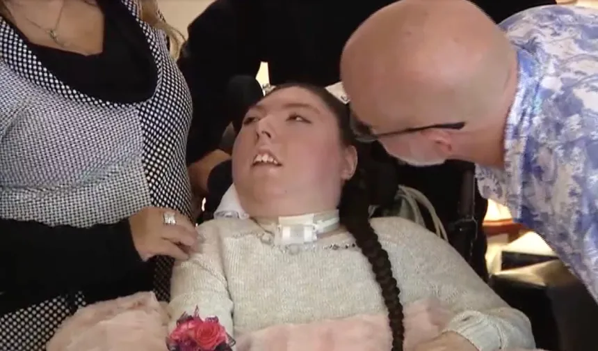 Beyni olmadan dünyaya gelmişti, şimdi 20 yaşında!