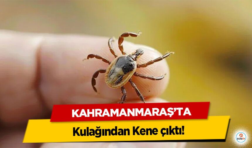 Kahramanmaraş’ta kulağından Kene çıktı!