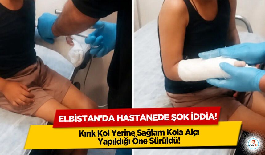 Elbistan’da hastanede şok iddia! Kırık Kol Yerine Sağlam Kola Alçı Yapıldığı Öne Sürüldü