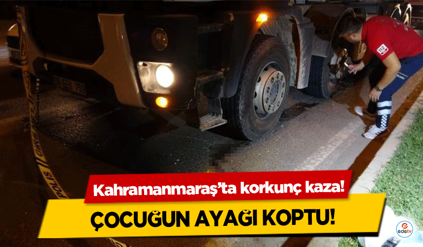 Kahramanmaraş’ta korkunç kaza! Çocuğun ayağı koptu!