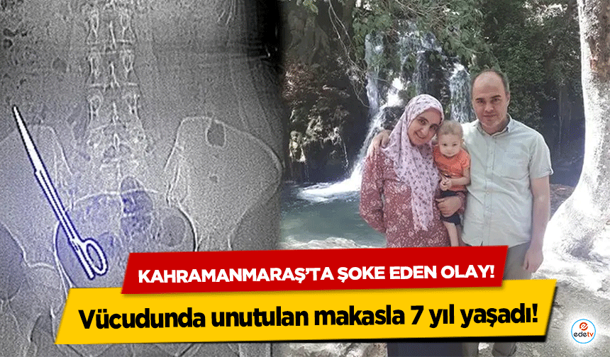 Kahramanmaraş’ta şoke eden olay! Vücudunda unutulan makasla 7 yıl yaşadı!