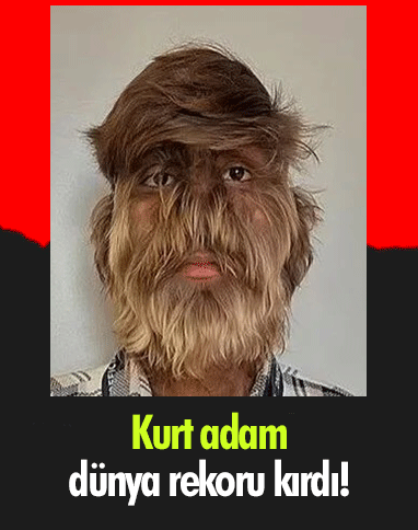Kurt adam dünya rekoru kırdı!