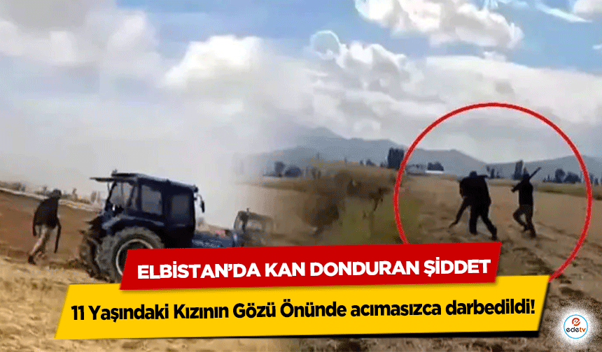 Elbistan’da Kan Donduran Şiddet: 11 Yaşındaki Kızının Gözü Önünde Sopalarla Darbedildi