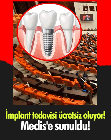 İmplant tedavisi ücretsiz oluyor! Meclis'e sunuldu!
